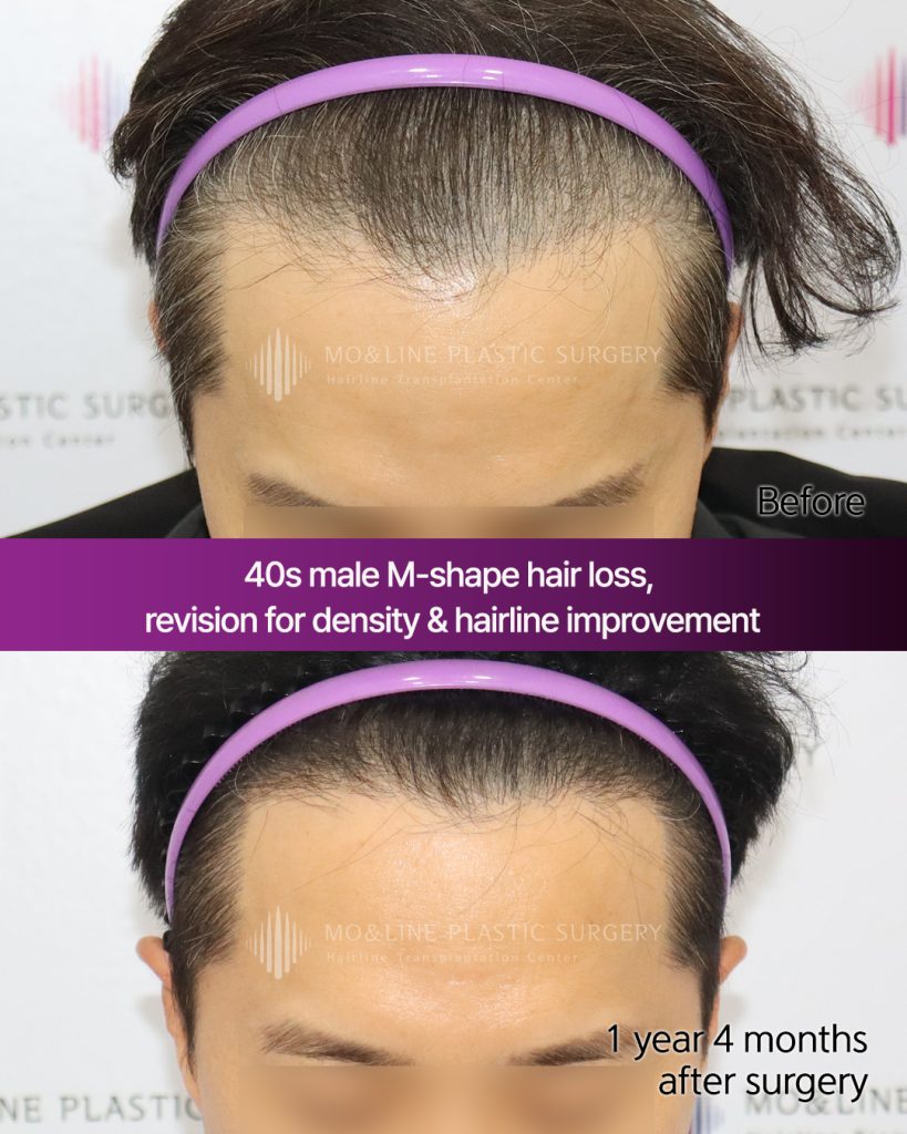 KakaoTalk_20251210_115356085_03